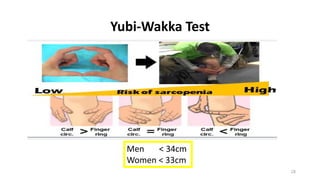 Yubi-Wakka Test
28
Men < 34cm
Women < 33cm
 