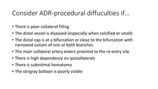 Jo Dens: Re-entry devices – essential or not? | PPTX