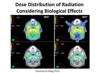 Dose Distribution of Radiation
Considering Biological Effects
49
Courtesy Lei Dong, Ph.D
IMRT IMPT
75Gy
10Gy
75Gy
45Gy
75Gy
10Gy
75Gy
45Gy
 