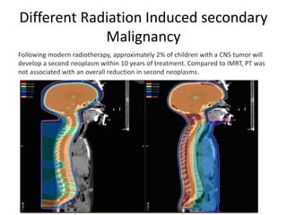 Different Radiation Induced secondary
Malignancy
Following modern radiotherapy, approximately 2% of children with a CNS tumor will
develop a second neoplasm within 10 years of treatment. Compared to IMRT, PT was
not associated with an overall reduction in second neoplasms.
 