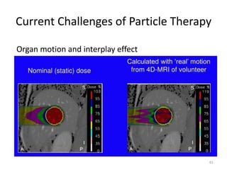 Current Challenges of Particle Therapy
61
Organ motion and interplay effect
 