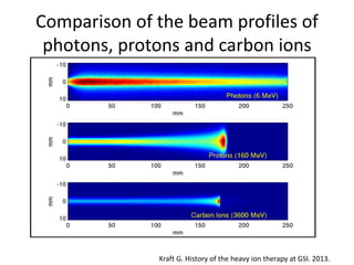Comparison of the beam profiles of
photons, protons and carbon ions
Kraft G. History of the heavy ion therapy at GSI. 2013.
 