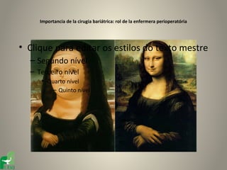 Importancia de la cirugia bariátrica: rol de la enfermera perioperatória




• Clique para editar os estilos do texto mestre
  – Segundo nível
  – Terceiro nível
     • Quarto nível
        – Quinto nível
 