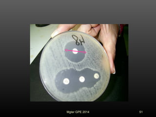 51Mgter GPE 2014
 