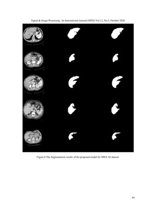 Bata-Unet: Deep Learning Model for Liver Segmentation | PDF