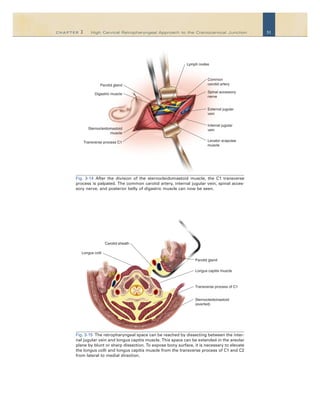 Surgical Anatomy And Techniques To The Spine Daniel H Kim Jeffrey Henn ...