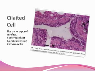 Cilaited
Cell
Has on its exposed
sureface,
numerous short
hairlike extension
known as cilia.
 