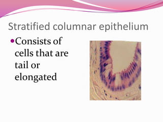 Stratified columnar epithelium
Consists of
cells that are
tail or
elongated
 
