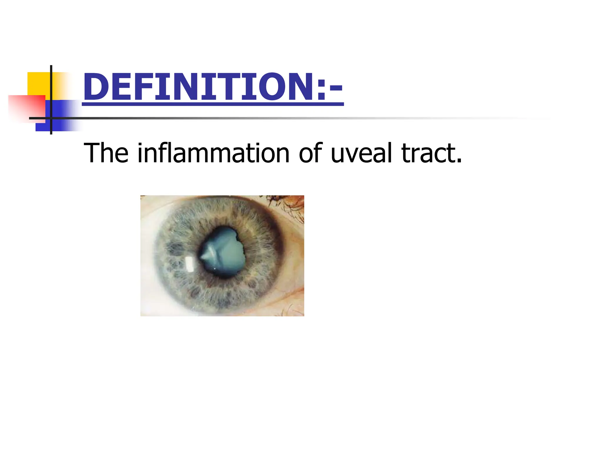 1167_Anterior-Uveitis.ppt (inflammation of iris, cilliary body, choroid ...