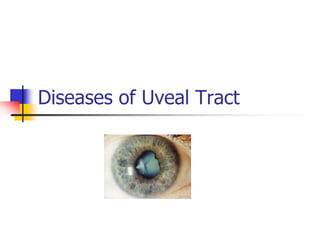 Diseases of Uveal Tract
 