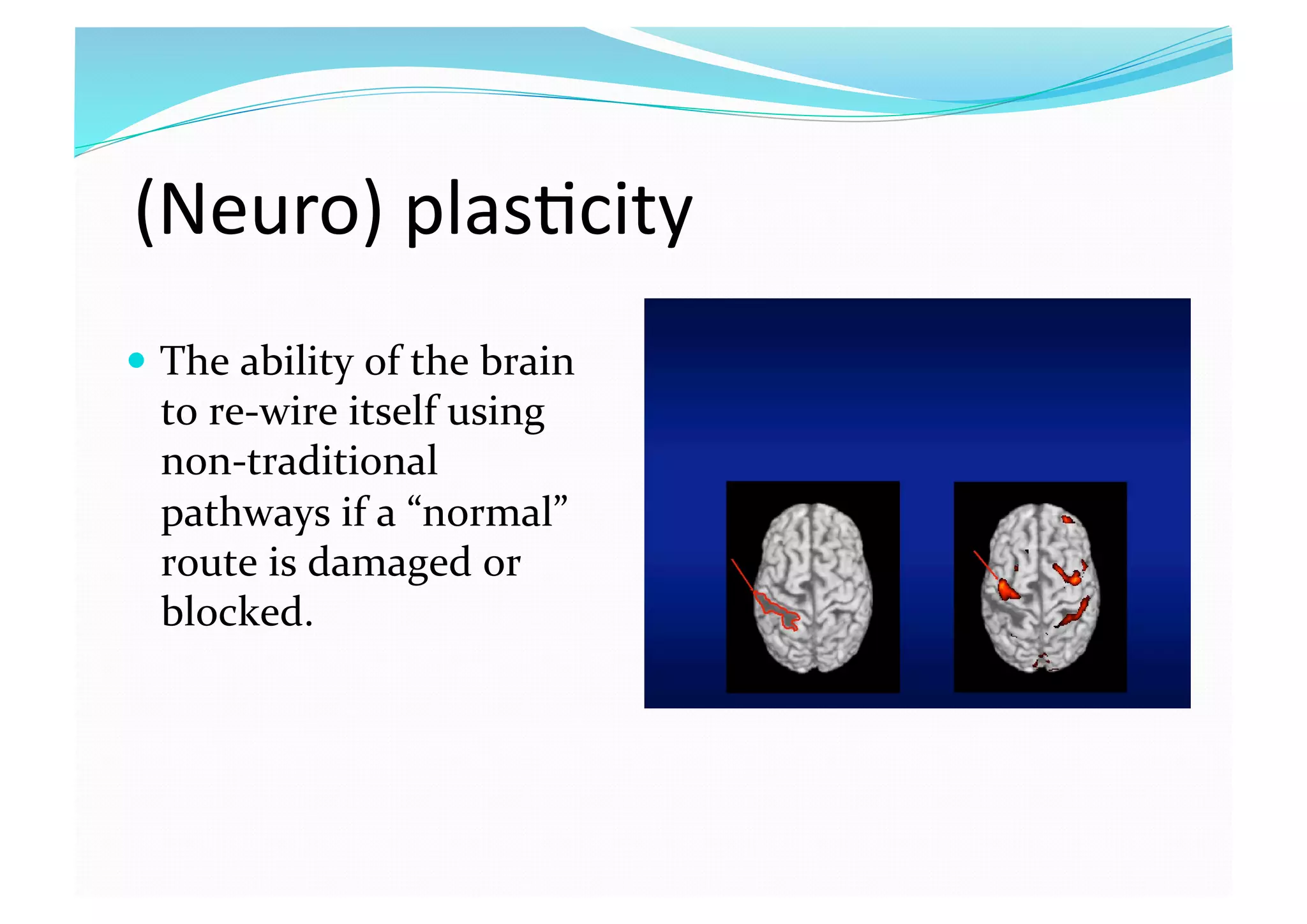 (Neuro) plas8city 
  The ability of the brain 
to re‐wire itself using 
non‐traditional 
pathways if a “normal” 
route is damaged or 
blocked.  
 