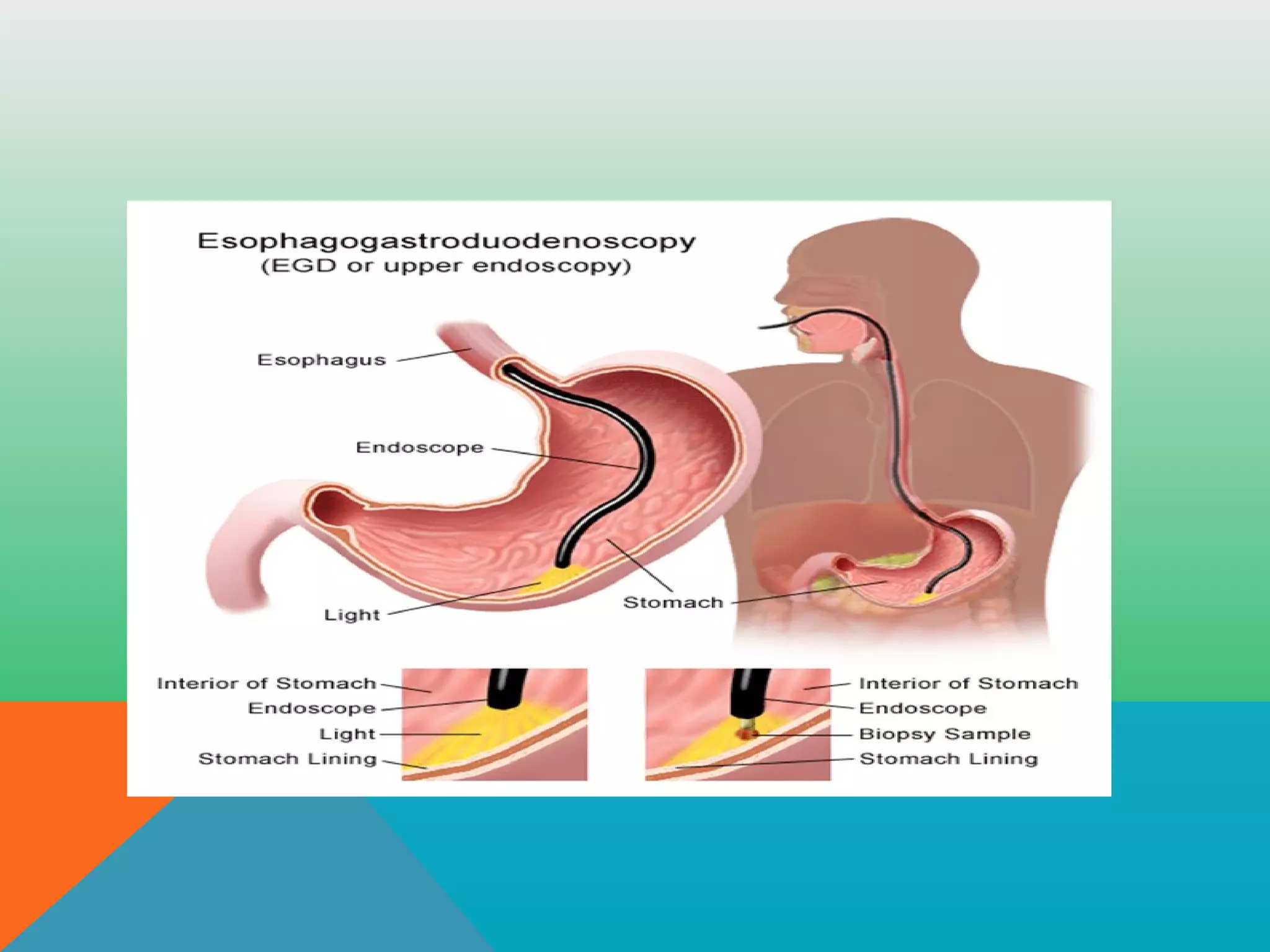Endascopy ENDOSCOPY | PPT