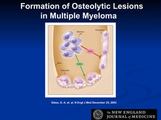 Glass, D. A. et. al. N Engl J Med December 25, 2003 Formation of Osteolytic Lesions in Multiple Myeloma 