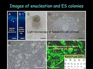 Images of enucleation and ES colonies Spindles before  enucleation After: spindles outside egg  Light microscopy of human ES cell colonies Immunofluorescence for nestin (marker of ES cells) Karyotype (2N) 