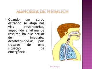  Quando um corpo
estranho se aloja nas
vias respiratórias,
impedindo a vítima de
respirar, há que actuar
de imediato,
desobstruindo-as, pois
trata-se de uma
situação de
emergência.
Mirian Rodrigues
 