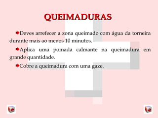 QQUUEEIIMMAADDUURRAASS 
Deves arrefecer a zona queimado com água da torneira 
durante mais ao menos 10 minutos. 
Aplica uma pomada calmante na queimadura em 
grande quantidade. 
Cobre a queimadura com uma gaze. 
 