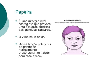 Papeira
 É uma infecção viral
contagiosa que provoca
uma dilatação dolorosa
das glândulas salivares.
 O vírus paira no ar.
 Uma infecção pelo vírus
da parotidite
normalmente
proporciona imunidade
para toda a vida.
A criança com papeira
Inchaço doloroso entre a orelha e o ângulo do maxilar.
 