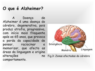 O que é Alzheimer?
A Doença de
Alzheimer é uma doença do
cérebro, degenerativa, pois
produz atrofia, progressiva,
com início mais frequente
após os 65 anos, que provoca
a perda da capacidade de
pensar, raciocinar e
memorizar, que afecta as
áreas da linguagem e origina
alterações no
comportamento.
Inteligência
Memória Linguagem
Fig.3: Zonas afectadas do cérebro
 