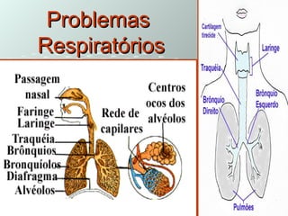 ProblemasProblemas
RespiratóriosRespiratórios
 