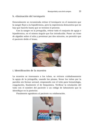 Bioseguridad y usos de la sangres 33
h. eliminación del torniquete
Generalmente se recomienda retirar el torniquete en el momento que
la sangre fluye a la hipodérmica, pero la experiencia demuestra que no
hay que hacerlo hasta que se termine el proceso.
Con la sangre en la jeringuilla, retirar todo el conjunto de aguja e
hipodérmica, en el mismo ángulo que fue introducida. Poner un trozo
de algodón sobre el sitio y presionar por dos minutos, no permitir que
el paciente doble el brazo.
i. Identificación de la muestra
La muestra se trasvasara a los tubos, se retirara cuidadosamente
la aguja de la jeringuilla, usando las pinzas, llenar los tubos por la
paredes sin formar aerosol, empezando con el tubo para hematología,
coagulación, finalmente el de bioquímica. Verificar la rotulación del
tubo con el nombre del paciente o un código de laboratorio que lo
identifique en lo posterior.
Finalmente agradezca al paciente su colaboración.
 