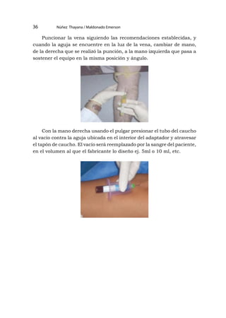 Núñez Thayana / Maldonado Emerson
36
Puncionar la vena siguiendo las recomendaciones establecidas, y
cuando la aguja se encuentre en la luz de la vena, cambiar de mano,
de la derecha que se realizó la punción, a la mano izquierda que pasa a
sostener el equipo en la misma posición y ángulo.
Con la mano derecha usando el pulgar presionar el tubo del caucho
al vacío contra la aguja ubicada en el interior del adaptador y atravesar
el tapón de caucho. El vacío será reemplazado por la sangre del paciente,
en el volumen al que el fabricante lo diseño ej. 5ml o 10 ml, etc.
 