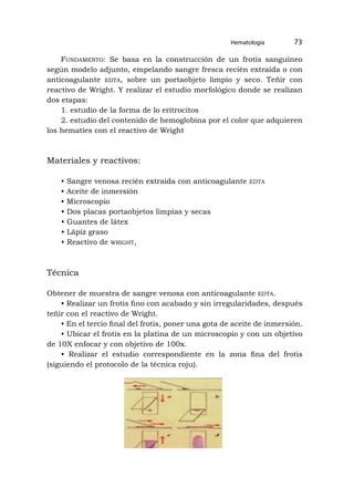 Hematología 73
Fundamento: Se basa en la construcción de un frotis sanguíneo
según modelo adjunto, empelando sangre fresca recién extraída o con
anticoagulante edta, sobre un portaobjeto limpio y seco. Teñir con
reactivo de Wright. Y realizar el estudio morfológico donde se realizan
dos etapas:
1. estudio de la forma de lo eritrocitos
2. estudio del contenido de hemoglobina por el color que adquieren
los hematíes con el reactivo de Wright
Materiales y reactivos:
• Sangre venosa recién extraída con anticoagulante edta
• Aceite de inmersión
• Microscopio
• Dos placas portaobjetos limpias y secas
• Guantes de látex
• Lápiz graso
• Reactivo de wright,
Técnica
Obtener de muestra de sangre venosa con anticoagulante edta.
• Realizar un frotis fino con acabado y sin irregularidades, después
teñir con el reactivo de Wright.
• En el tercio final del frotis, poner una gota de aceite de inmersión.
• Ubicar el frotis en la platina de un microscopio y con un objetivo
de 10X enfocar y con objetivo de 100x.
• Realizar el estudio correspondiente en la zona fina del frotis
(siguiendo el protocolo de la técnica roju).
 