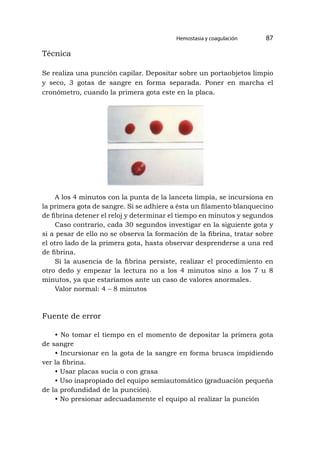 Hemostasia y coagulación 87
Técnica
Se realiza una punción capilar. Depositar sobre un portaobjetos limpio
y seco, 3 gotas de sangre en forma separada. Poner en marcha el
cronómetro, cuando la primera gota este en la placa.
A los 4 minutos con la punta de la lanceta limpia, se incursiona en
la primera gota de sangre. Si se adhiere a ésta un filamento blanquecino
de fibrina detener el reloj y determinar el tiempo en minutos y segundos
Caso contrario, cada 30 segundos investigar en la siguiente gota y
si a pesar de ello no se observa la formación de la fibrina, tratar sobre
el otro lado de la primera gota, hasta observar desprenderse a una red
de fibrina.
Si la ausencia de la fibrina persiste, realizar el procedimiento en
otro dedo y empezar la lectura no a los 4 minutos sino a los 7 u 8
minutos, ya que estaríamos ante un caso de valores anormales.
Valor normal: 4 – 8 minutos
Fuente de error
• No tomar el tiempo en el momento de depositar la primera gota
de sangre
• Incursionar en la gota de la sangre en forma brusca impidiendo
ver la fibrina.
• Usar placas sucia o con grasa
• Uso inapropiado del equipo semiautomático (graduación pequeña
de la profundidad de la punción).
• No presionar adecuadamente el equipo al realizar la punción
 