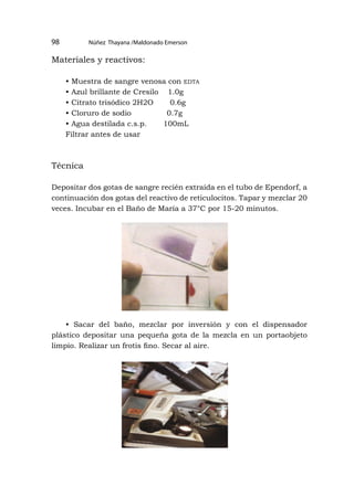 Núñez Thayana /Maldonado Emerson
98
Materiales y reactivos:
• Muestra de sangre venosa con edta
• Azul brillante de Cresilo 1.0g
• Citrato trisódico 2H2O 0.6g
• Cloruro de sodio 0.7g
• Agua destilada c.s.p. 100mL
Filtrar antes de usar
Técnica
Depositar dos gotas de sangre recién extraída en el tubo de Ependorf, a
continuación dos gotas del reactivo de reticulocitos. Tapar y mezclar 20
veces. Incubar en el Baño de María a 37°C por 15-20 minutos.
• Sacar del baño, mezclar por inversión y con el dispensador
plástico depositar una pequeña gota de la mezcla en un portaobjeto
limpio. Realizar un frotis fino. Secar al aire.
 