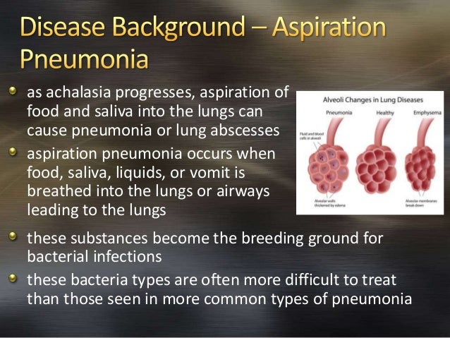 Achalasia with Aspiration Pneumonia