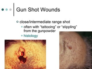 Gun Shot Wounds close/intermediate range shot often with “tattooing” or “stippling” from the gunpowder histology 
