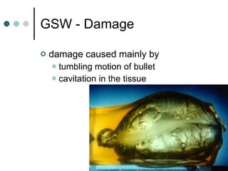 GSW - Damage damage caused mainly by tumbling motion of bullet cavitation in the tissue 