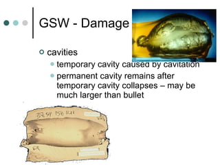 GSW - Damage cavities temporary cavity caused by cavitation permanent cavity remains after temporary cavity collapses – may be much larger than bullet 