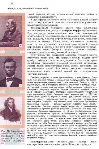 58
РАЗДЕЛ III, Организменный уровень жизни
такой окраски шерсти, одновременно вызывает зябкость,
бесплодие и карликовость.
У дрозофилы ген белого цвета глаз также влияет на цвет
тела, длину крыльев, снижает плодовитость и уменьшает
продолжительность жизни.
Плейотропным действием одного гена объясняется
наследственная патология — синдром Марфана у человека.
Эта патология характеризуется тем, что доминантный
аллель одного гена обуславливает аномалию пальцев («пау­
чьи пальцы»), а также дефект хрусталика глаза, аномалию
скелета и сердца. Кроме таких негативных влияний,
этот ген «дарит» своему владельцу повышенный уровень
адреналина в крови, а вместе с ним чрезвычайную трудо­
способность, очень быстрые реакции, словом, качества,
которые отвечают эпитету «горячий человек».
Неслучайно, что синдромом Марфана страдали многие
известные люди (рис. 38), которые сумели создать свою
судьбу, добиться славы и популярности благодаря чрез­
вычайному трудолюбию и высокой жизненной активности.
Узнать таких знаменитостей очень легко: вспомните, кто
из известных людей был очень высоким, худощавым,
нескладным, имел длинный тонкий нос и предлинные
«паучьи» пальцы.
Синдром Марфана — цена чрезвычайного успеха Никколо Пага­
нини, чьи длинные пальцы и невероятная лихорадочность при выпол­
нении музыкальных произведений стали легендой. Вплоть до XX в.
ходили слухи, что в молодости Паганини обратился к помощи хирур­
га, который сделал ему операцию, чтобы повысить гибкость рук.
Синдромом Марфана страдал Авраам Линкольн, который, начав
свою карьеру лесорубом, благодаря ошеломляющему трудолюбию
стал президентом США. Линкольн имел высокий рост — 193 см,
чрезвычайно длинные ступни и кисти рук, гибкие пальцы, узкую
грудную клетку, нескладную фигуру — типичное телосложение
при синдроме Марфана. Эту болезнь имел ещё один чрезвычайно
талантливый человек — великий детский писатель Ганс Христи­
ан Андерсен. Сегодня премия имени Андерсена — своеобразная
«Нобелевская премия» детским писателям. Известно, что свои про­
изведения Андерсен переписывал по 10 раз. Необыкновенное тру­
долюбие, потрясающая чуткость и возбудимость нервной системы,
впечатлительность и эмоциональность — результат действия адре­
налина — сделали сына сапожника известным многим поколени­
ям читателей всего мира. Внешность Андерсена современники
описывали так: «Он был высокий, худощавый и крайне своеобразный
по осанке и движениям. Руки и ноги его были несоразмерно длинные
и тонкие, кисти рук широкие и плоские, а ступни ног таких огромных
размеров, что ему, вероятно, никогда не приходилось беспокоиться,
что кто-нибудь подменит его калоши. Нос его был так называемой
римской формы, но тоже несоразмерно большой и как-то особенно
выдавался вперёд».
Полимерия (от поли — много и мерос — части) — явле­
ние, противоположное плейотропии. Если для плейотро-
 