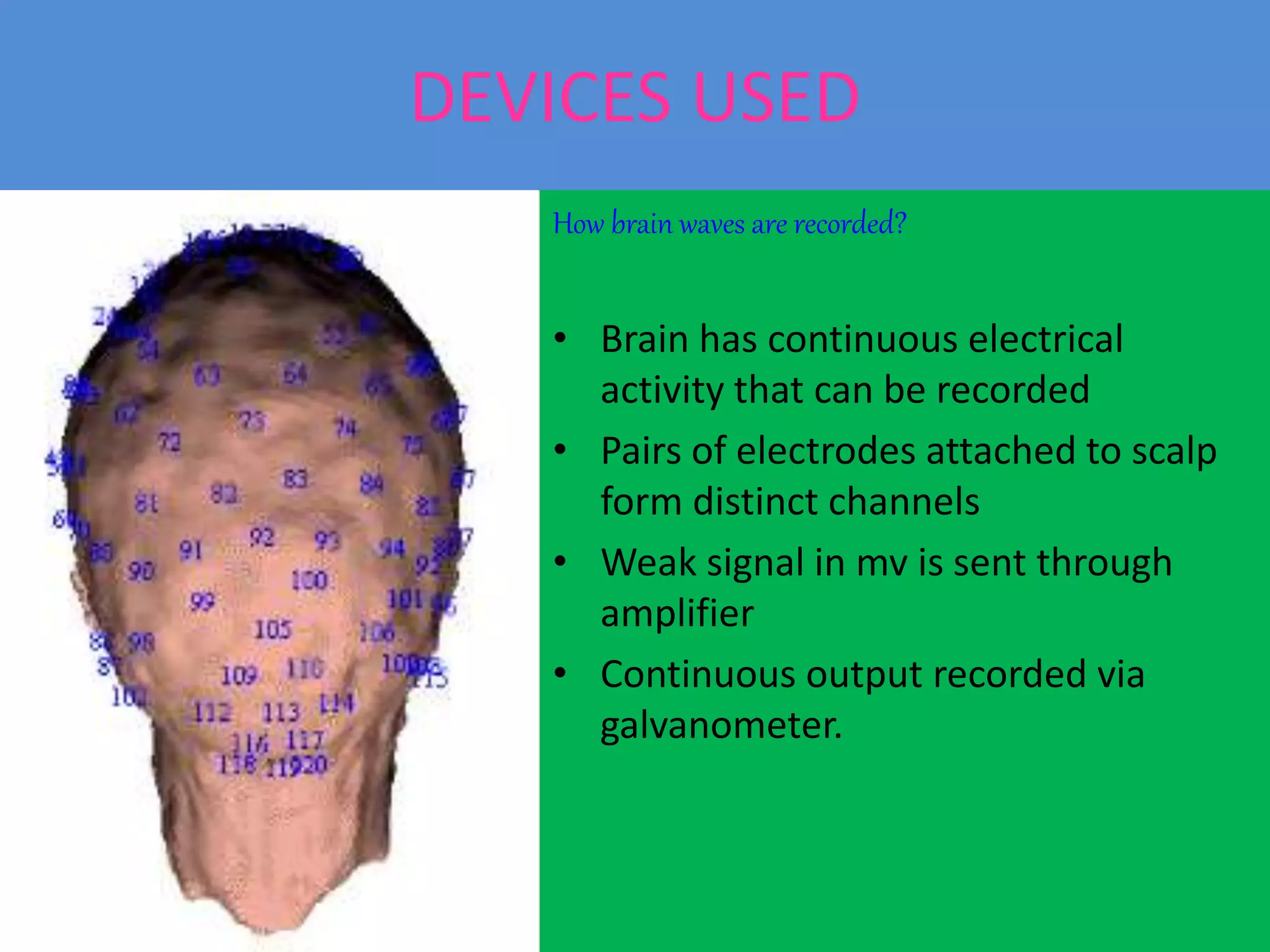 DEVICES USED
How brain waves are recorded?
• Brain has continuous electrical
activity that can be recorded
• Pairs of electrodes attached to scalp
form distinct channels
• Weak signal in mv is sent through
amplifier
• Continuous output recorded via
galvanometer.
 