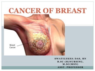 SWA T ILEK HA DA S, RN
B .SC (H)NU RSING,
M .SC (M SN)
A SST . PRO FESSO R
CANCER OF BREAST
 