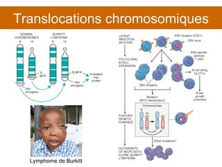 Translocations chromosomiques Lymphome de Burkitt  