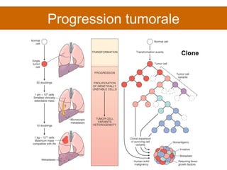 Progression tumorale Clone 