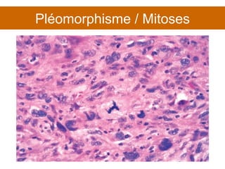 Pléomorphisme / Mitoses 