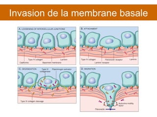 Invasion de la membrane basale 
