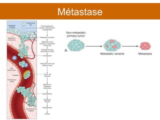 Métastase 