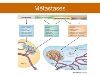 Métastases 