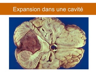 Expansion dans une cavité 