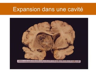 Expansion dans une cavité 