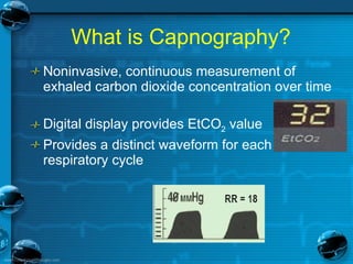 11 capnography | PPT