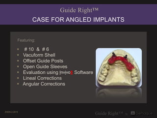 Guide Right™
                  CASE FOR ANGLED IMPLANTS


          Featuring:

              # 10 & # 6
             Vacuform Shell
             Offset Guide Posts
             Open Guide Sleeves
             Evaluation using Invivo5 Software
             Lineal Corrections
             Angular Corrections




ZHEN 2.2013
 