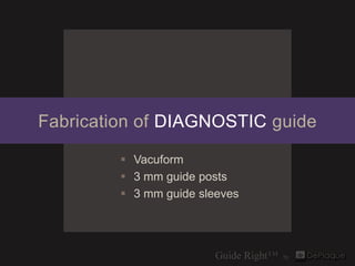Fabrication of DIAGNOSTIC guide

          Vacuform
          3 mm guide posts
          3 mm guide sleeves
 