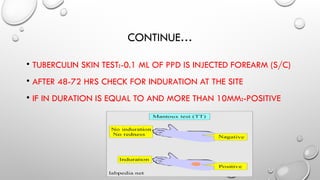 Tuberculosis adult health nursing...pptx