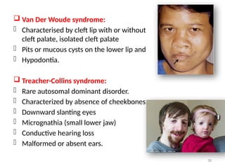 11 CLEFT LIP AND PALATE.pptx orthodontics | PPTX