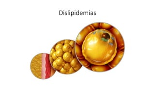 Dislipidemias
 