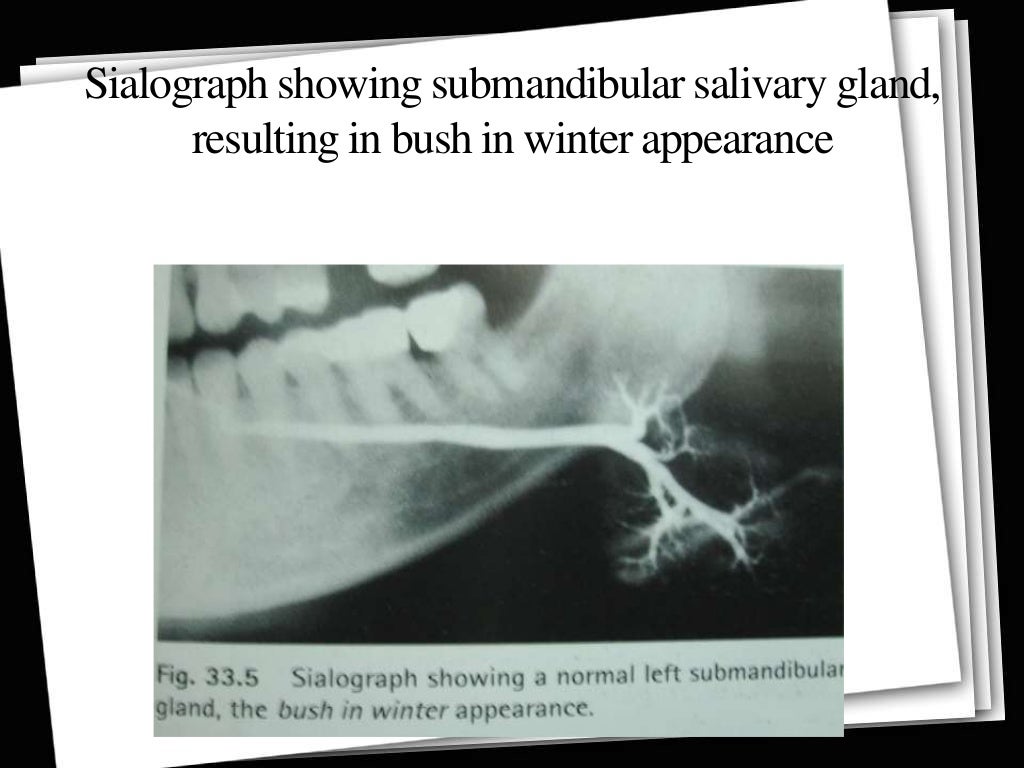 Contrast Radiography